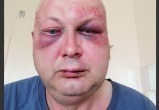 Минский милиционер избил мужчину и пошел в кочегары, чтобы не платить компенсацию