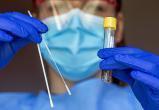 Минздрав подключил частные лаборатории к тестированию на коронавирус
