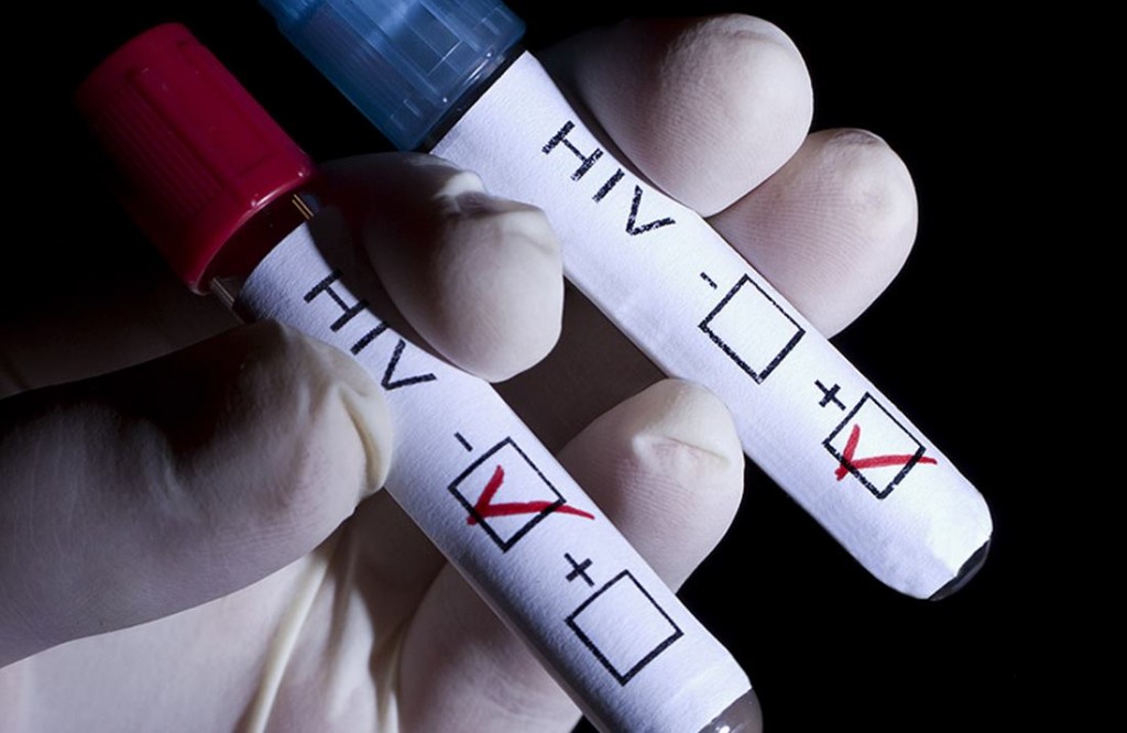 Как сдать тест на ВИЧ в Бресте?