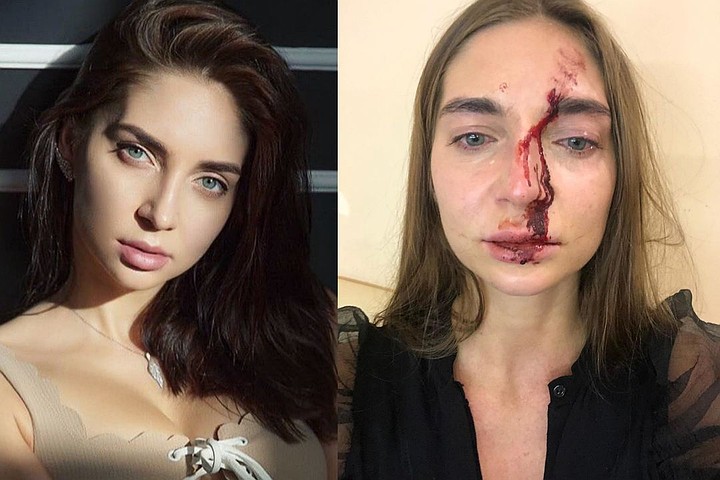 Видео: новосибирскую певицу избили в московском салоне красоты