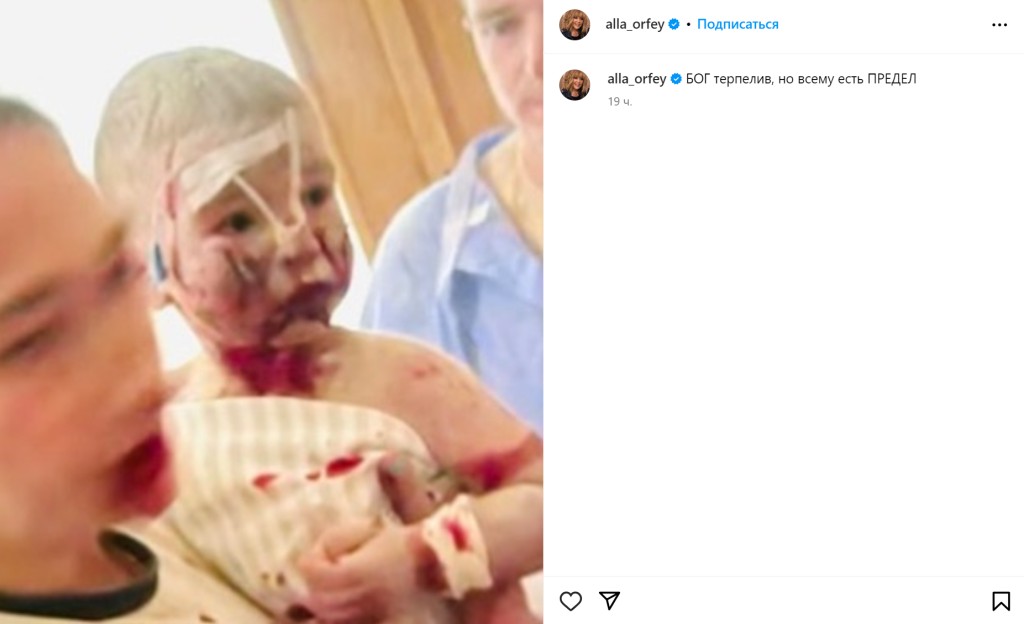Пугачеву хотят признать иноагентом из-за слов об ударе по детской больнице в Киеве