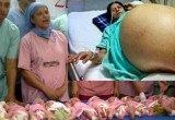 Индианка родила 11 здоровых детей за 40 минут