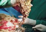 Хирург нашел в желудке пациентки клад