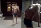 В России голый мужчина вышел покурить из больницы с ножом в спине (видео)