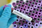 От коронавируса в Китае погибли 1380 человек