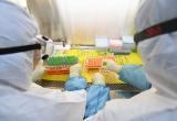 Ученые нашли препарат, подавляющий коронавирус за двое суток