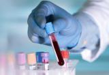 Тесты на антитела к коронавирусу поступят в Беларусь в конце апреля