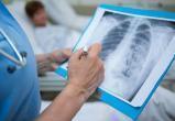 В Бресте 223 человека госпитализированы с пневмониями