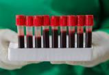 Доказана связь между коронавирусом и группой крови
