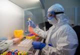 Ученые: британский штамм коронавируса не вызывает повышенную смертность