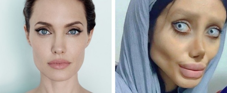 Иранка сделала 50 операций ради сходства с Анджелиной Джоли: как сейчас выглядит девушка