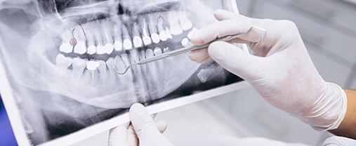 Минздрав увеличил на 30% максимальные тарифы на стоматологические услуги