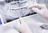 Минздрав увеличил на 30% максимальные тарифы на стоматологические услуги