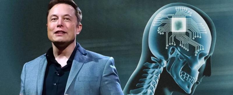 Neuralink готовится чипировать 20 тысяч человек в год: подробности амбициозного плана