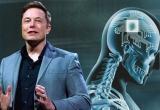 Neuralink готовится чипировать 20 тысяч человек в год: подробности амбициозного плана