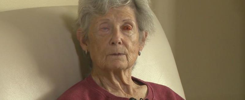 «Зуб в глаз»: 75-летней канадке вернули зрение с помощью необычной операции